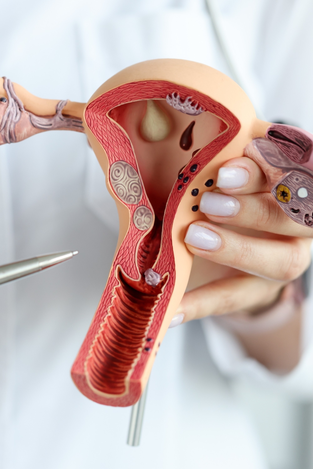 Spugna contraccettiva