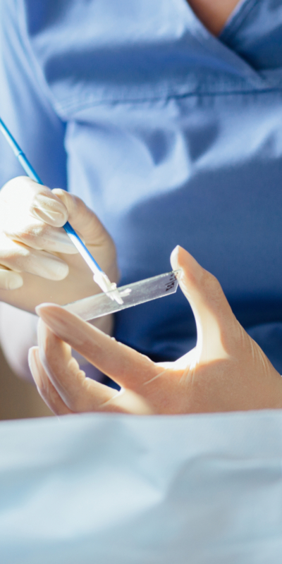 A cosa serve il pap test