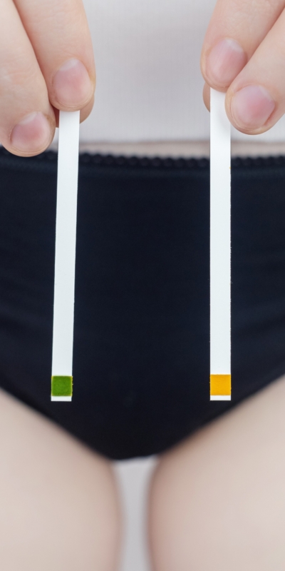 Alterazione ph vaginale