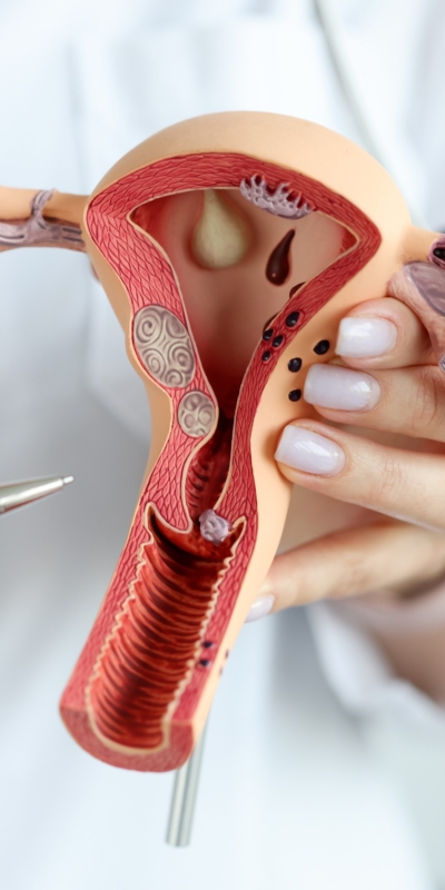 Spugna contraccettiva