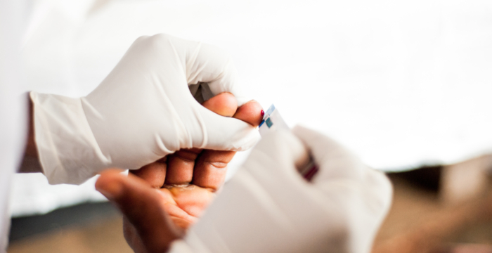 Diagnosi hiv
