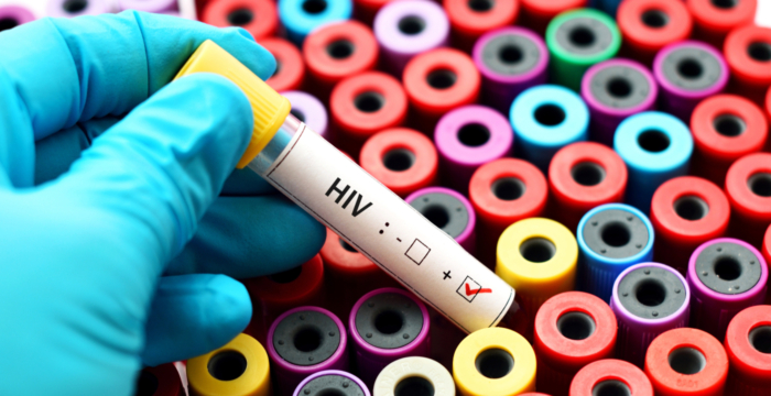 Hiv malattia