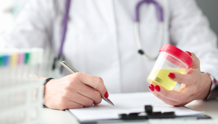 Trattamento cistite post coitale